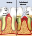 /album/periodontics/periodontics-3-jpg/